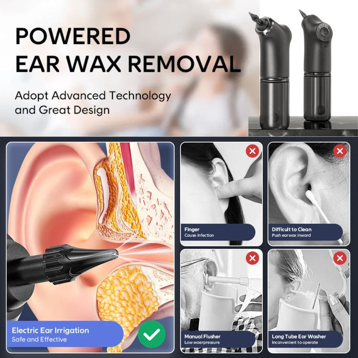 USB Rechargeable Earwax Removal Kit with 200ml Water Flusher Tank