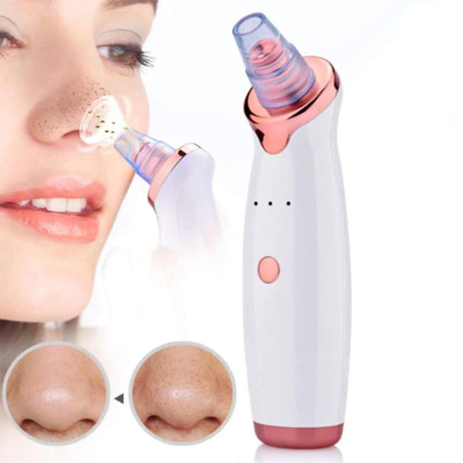 Bostin Life Acne Pimple Blackhead Remover Deep Cleaner For Face T Zone And Nose Vacuum Suction