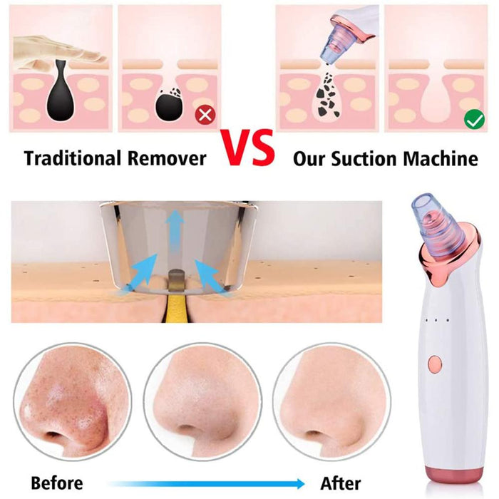 Acne Pimple Blackhead Remover Deep Cleaner for Face T Zone and Nose Vacuum Suction Machine Facial Beauty_11