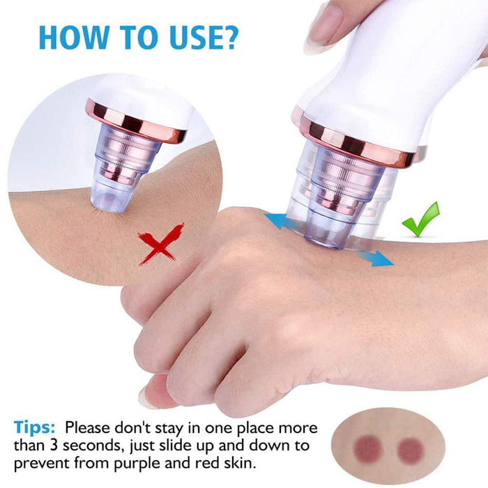 Acne Pimple Blackhead Remover Deep Cleaner for Face T Zone and Nose Vacuum Suction Machine Facial Beauty_4