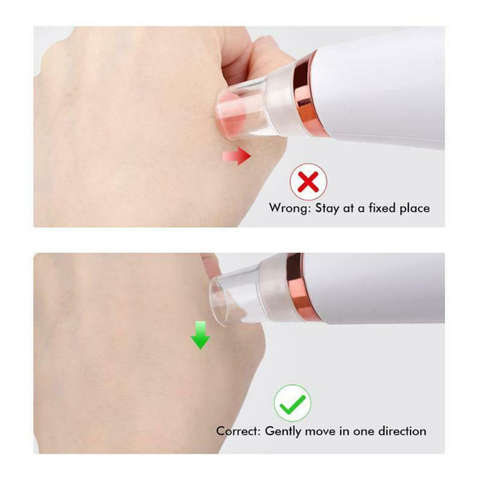 6 Nozzle Electric Acne Pimple Blackhead Remover Pore Deep Cleaner for Face and Nose Vacuum Suction Machine Facial Beauty_5