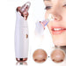 5 Nozzle Facial Blackhead Remover Electric Pore Cleaner Electric Suction Pore Cleaner_2