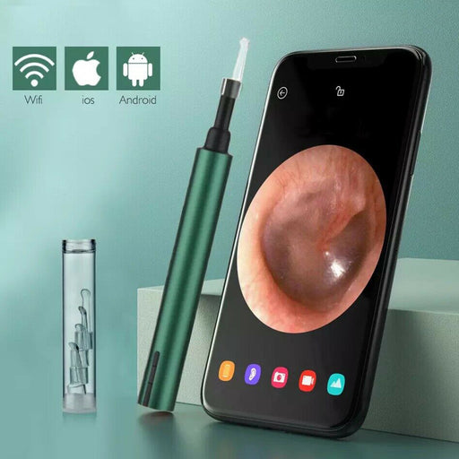 WI-FI Enabled HD Wireless Otoscope Earwax Remover Visual Ear Cleaner_6