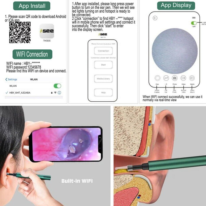 WI-FI Enabled HD Wireless Otoscope Earwax Remover Visual Ear Cleaner_10