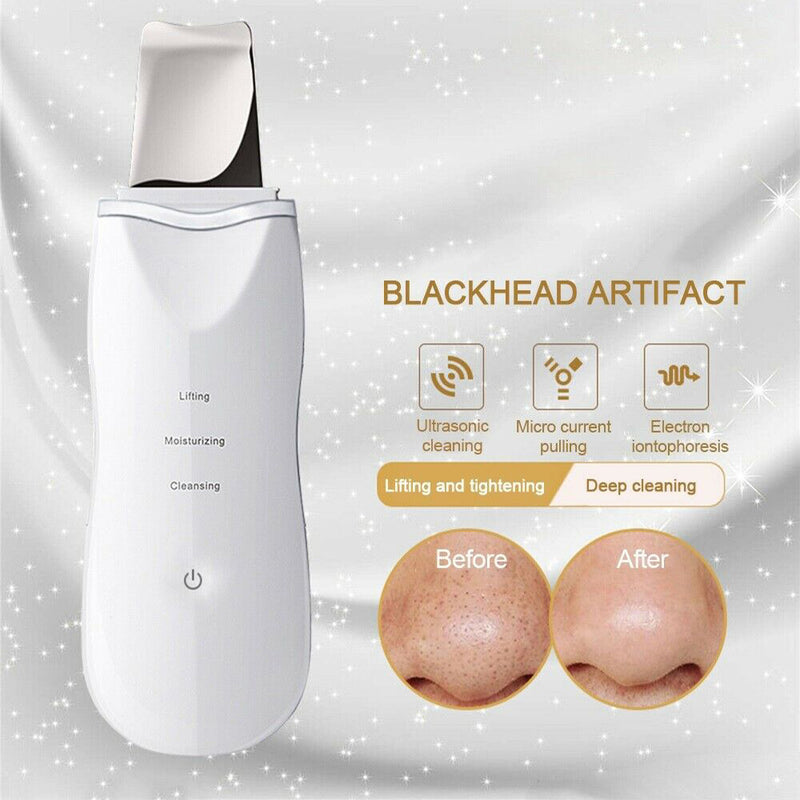 Ultra-Sonic Deep Facial Skin Cleansing Machine Facial Scrubber_8