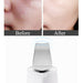 Ultra-Sonic Deep Facial Skin Cleansing Machine Facial Scrubber_9