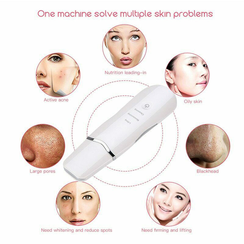 Ultra-Sonic Deep Facial Skin Cleansing Machine Facial Scrubber_5