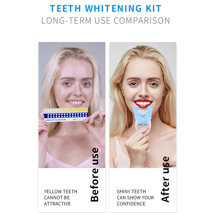 Teeth Whitening Kit with LED Light Professional Oral Cleaning Machine_4
