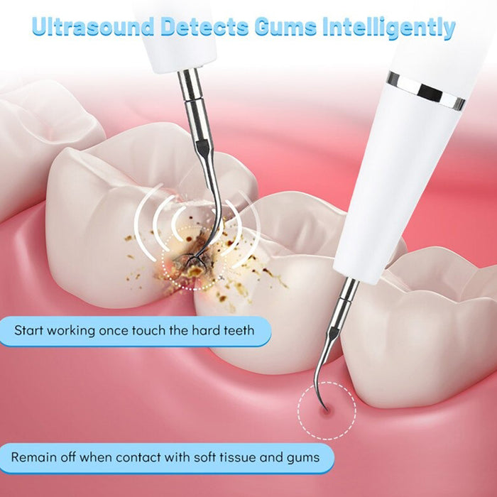 Ultrasonic Portable Electric Teeth Dental Scaler with LED Display_9
