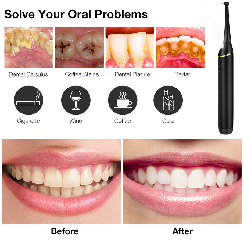 Professional Electric Teeth Cleaner-Toothbrush Water Flosser_2