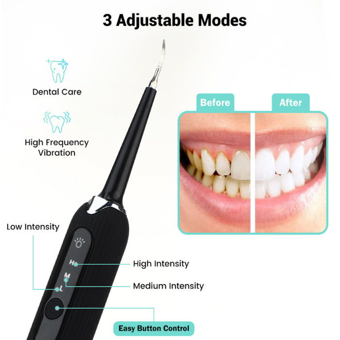 Rechargeable Electric Tooth Plaque Cleaning Kit with LED Light_0