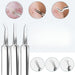 15Pcs  Stainless Steel Blackhead Remover Pimple Popper Tools Kit with Metal Case_5