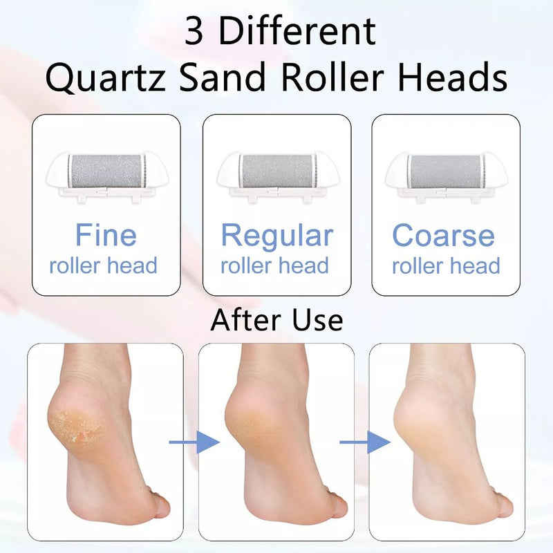 Portable Electric Foot File and Callus Remover - USB Rechargeable